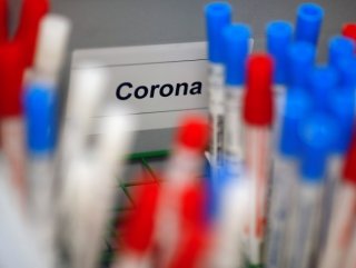 Russia starts testing corona vaccines
