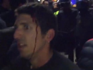 Spanish police didn’t have mercy on protesters