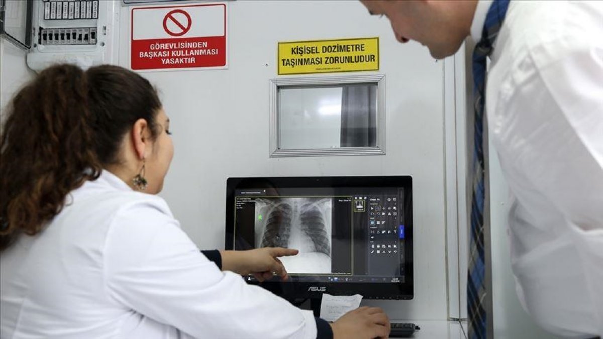Turkey remains below average for tuberculosis-related deaths
