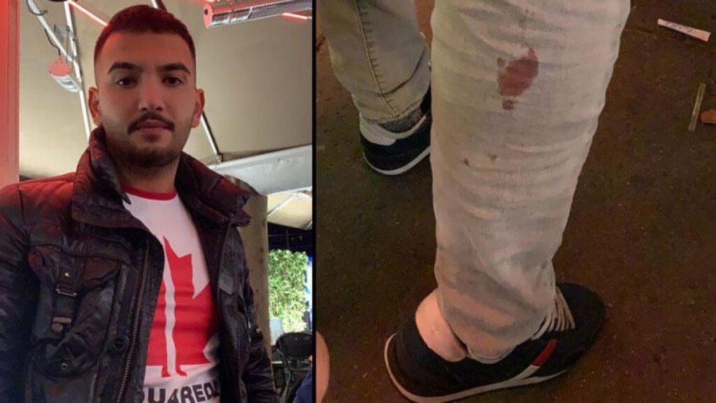Turkish man survives from being shot in Vienna terror attack