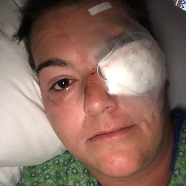 US reporter shot in the eye with rubber bullet by police