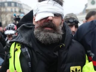Yellow Vests leader hit in eye disabled for life